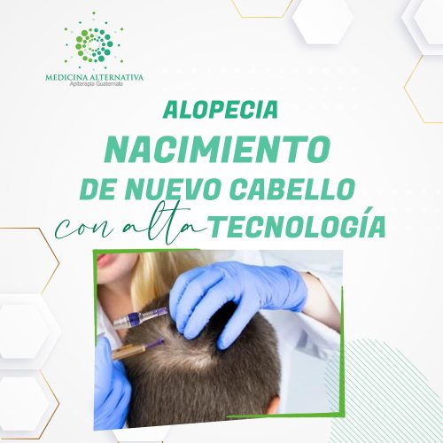 Alopecia